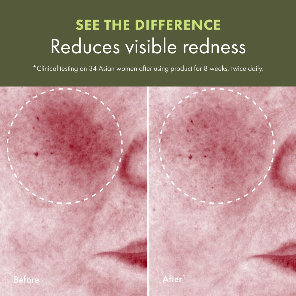 Lotion traitante apaisante Mega-Mushroom Relief & Resilience Dr. Andrew Weil for Origins™, 200 ml