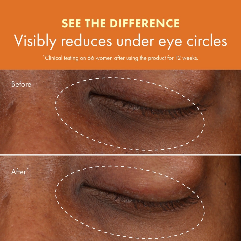 Crème pour les yeux illuminatrice avec vitamine C et niacinamide GinZing™, Clair, 15 ml